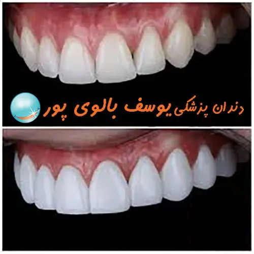 دندان ۳