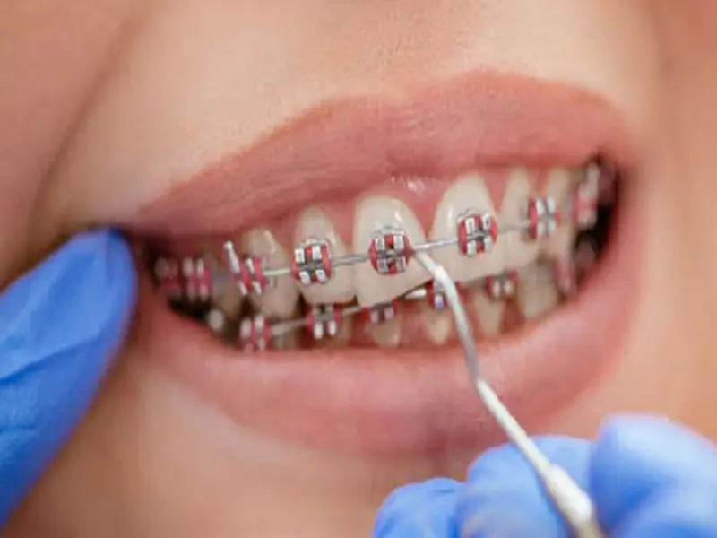  تفاوت بین ارتودنتیست و دندانپزشک چیست؟ 
