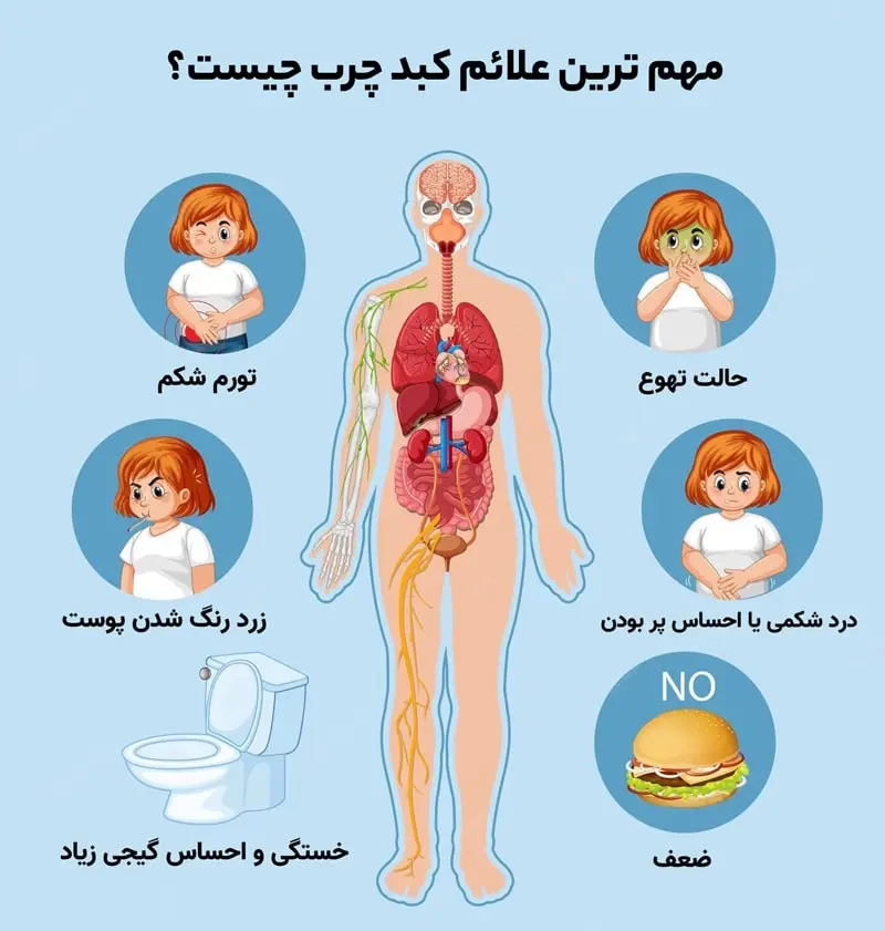 علائم_کبد_چرب