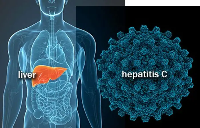 hepatitC.jpg