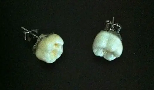 گوشواره-دندان
