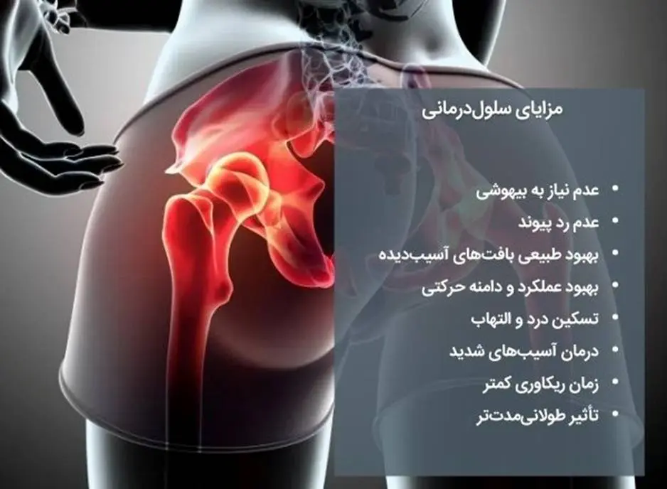 درمان آرتروز لگن با سلول های بنیادی