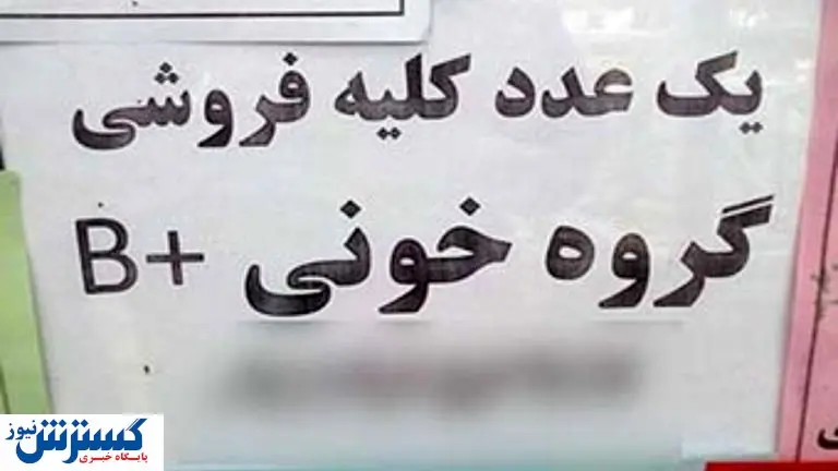 قیمت عجیب کلیه در بازار ایران (۱۴۰۰)