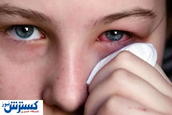 کرونا بر روی بینایی تاثیر میگذارد؟