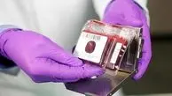 ۲۰۰ هزار نمونه خون بند ناف ذخیره در بانک خون 