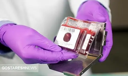 ۲۰۰ هزار نمونه خون بند ناف ذخیره در بانک خون 