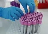 واکنش وزارت بهداشت به خبر کشف واکسن کرونا