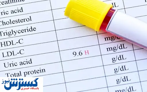 خوراکیهای ممنوع در زمان اسید اوریک بالا