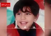 عمل نادر جراحی روی مغز کودک یک و نیم ساله شیرازی + فیلم