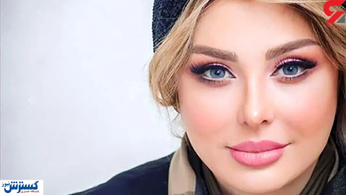 زخم خونین صورت نیوشا ضیغی! / سرش هم باندپیچی است ! + عکس