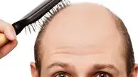 ۵ روش ارزان برای جلوگیری از ریزش موی آقایان‌