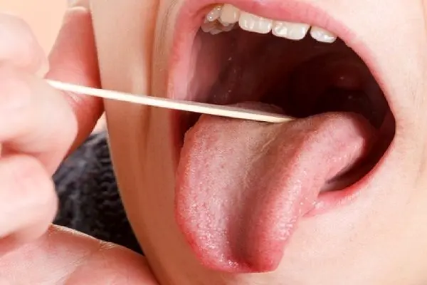 خشکی دهان را درمان کنید تا کرونا نگیرید