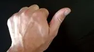 نشانه خطرناک لرزش انگشت شست 