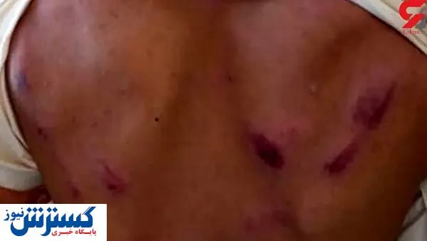 ضرب و شتم شدید دانش آموز سیستانی توسط یک معلم+ عکس
