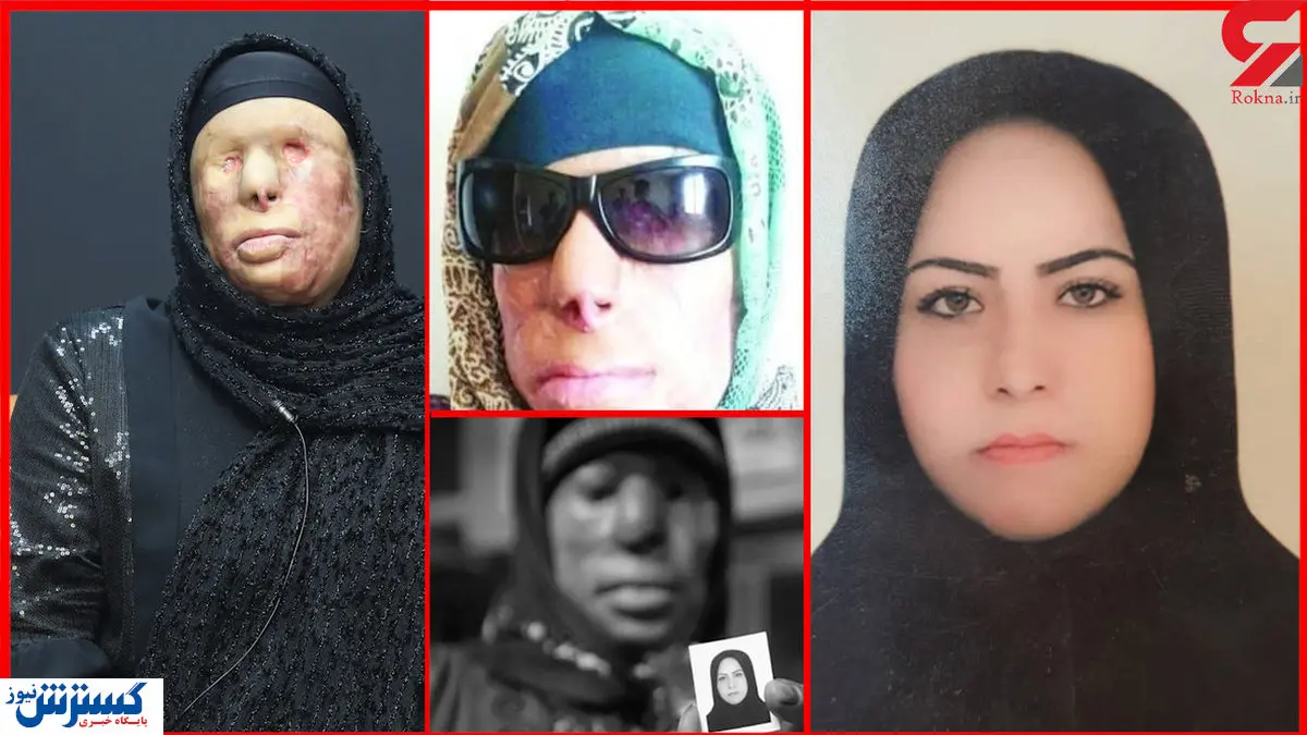 مادر کور و فرزند کشته شد! هولناکترین ماجرای اسیدپاشی / عکس