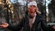  عکس تکان دهنده از حمله به زن اوکراینی + عکس