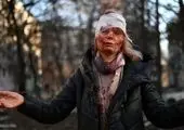 بازیگر مشهور اوکراینی در گلوله باران کشته شد + عکس