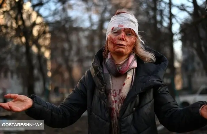  عکس تکان دهنده از حمله به زن اوکراینی + عکس