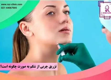 یک بار برای همیشه با چین و چروک صورتتان خداحافظی کنید! 