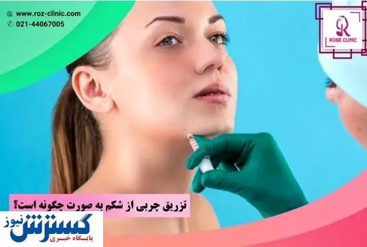 آشنایی با روشهای جوانسازی پوست در کلینیک پوست و موی رز