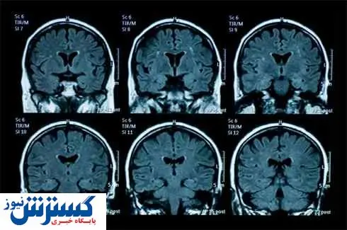 عوامل دستکاری گزارش ‌های MRI دستگیر شدند! 