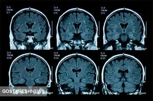 عوامل دستکاری گزارش ‌های MRI دستگیر شدند! 