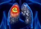 تأثیر دخانیات بر سیستم ایمنی بدن