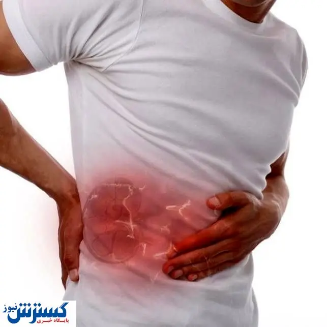 چگونه با آبلیمو سنگ کلیه را دفع کنیم + راه حل موثر