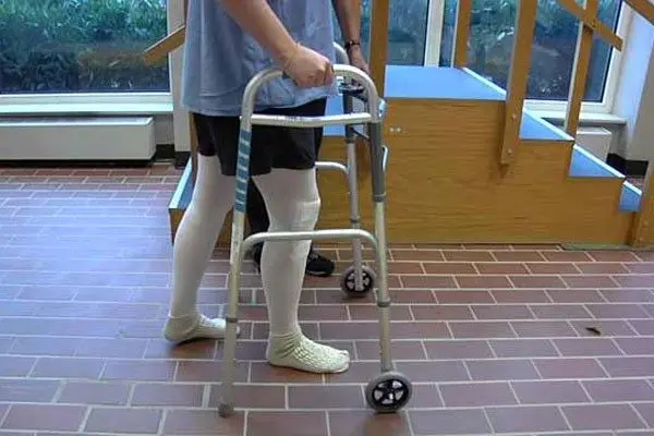 چند روز بعد از عمل زانو میتوان راه رفت؟
