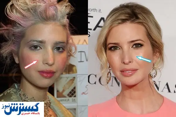 ماجرای دماغ عملی ایوانکا ترامپ + عکس