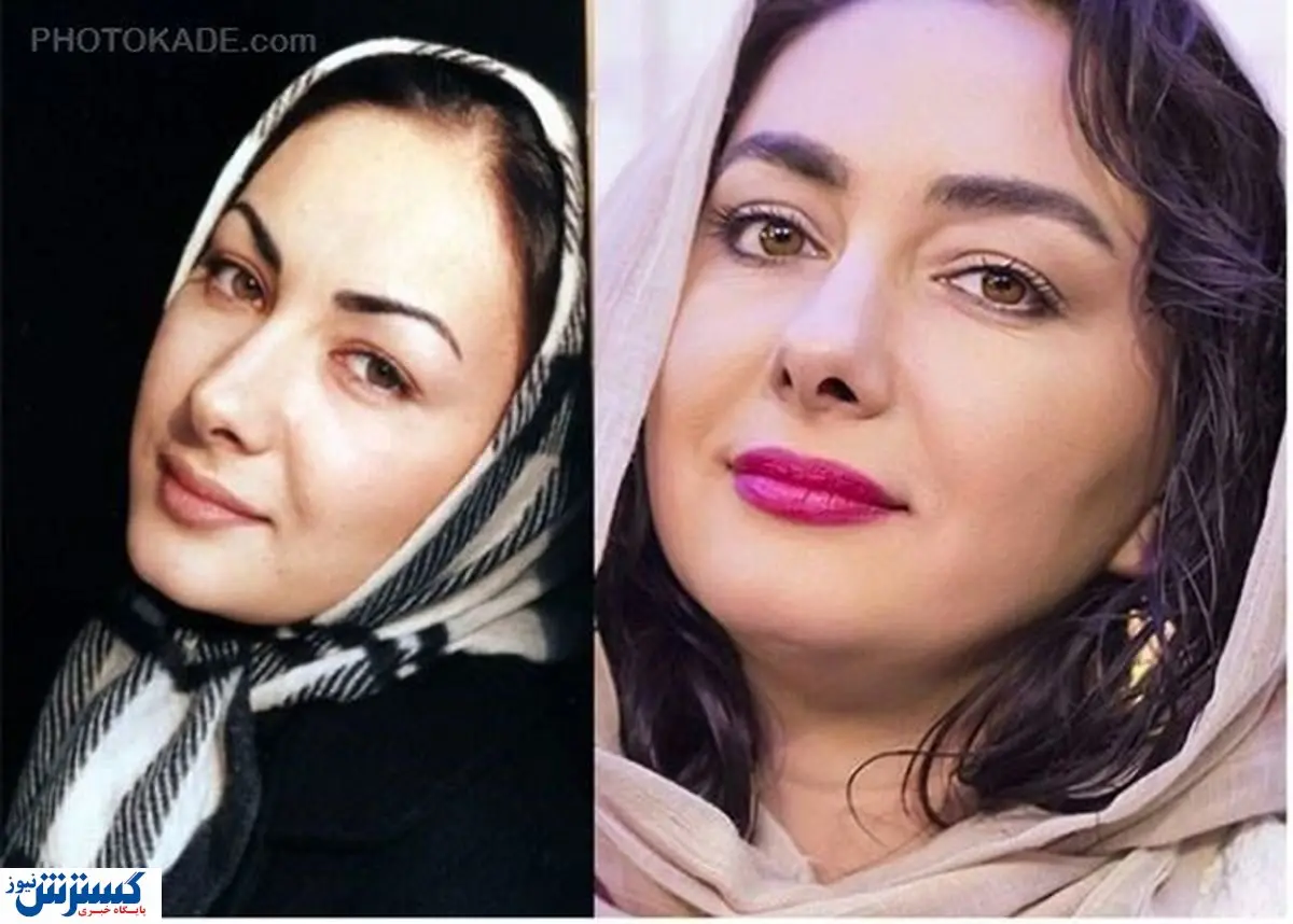 چرا هانیه توسلی بازیگر زخم کاری ازدواج نمی کند؟ | بیوگرافی هانیه توسلی