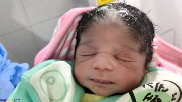 تولد نوزادی با موهای سفید