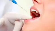 دندانپزشکی در کدام کشور دنیا بهتر است؟