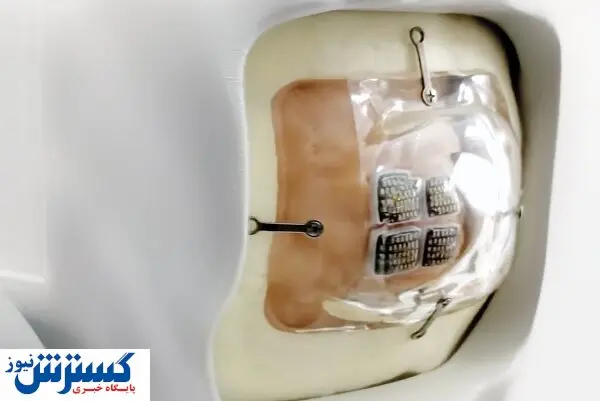 ساخت چشمی که هر نابینایی را بینا می کند!