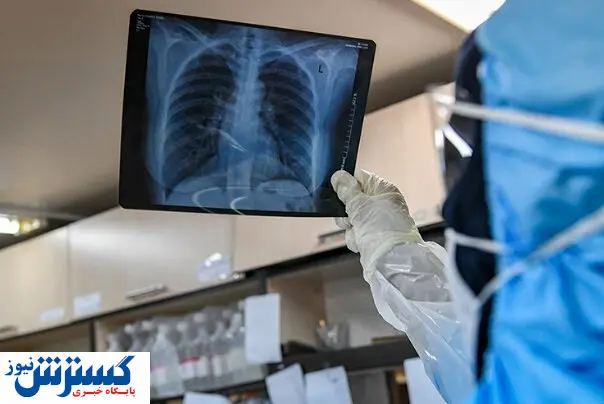 با این روش ریه های خود را در برابر کرونا ایمن کنید