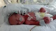 مرگ مشکوک دو نوزاد در بیمارستان