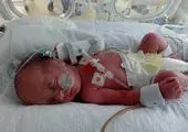 واکنش علوم پزشکی ایلام به زنده شدن نوزاد آبدانانی