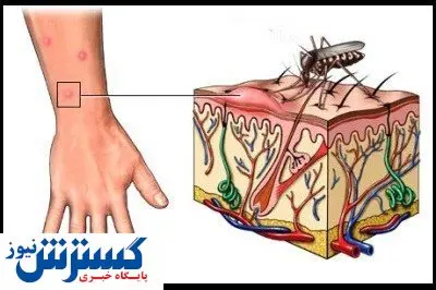 هشدار / این بیماری جان شمارا می گیرد