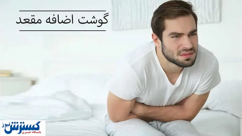 گوشت اضافه یا زائده مقعد و راههای درمان