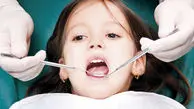 علل فاصله میان دندان‌ ها چیست؟
