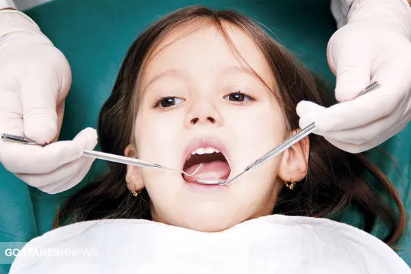 اهمیت توجه والدین به بهداشت دهان و دندان کودکان 