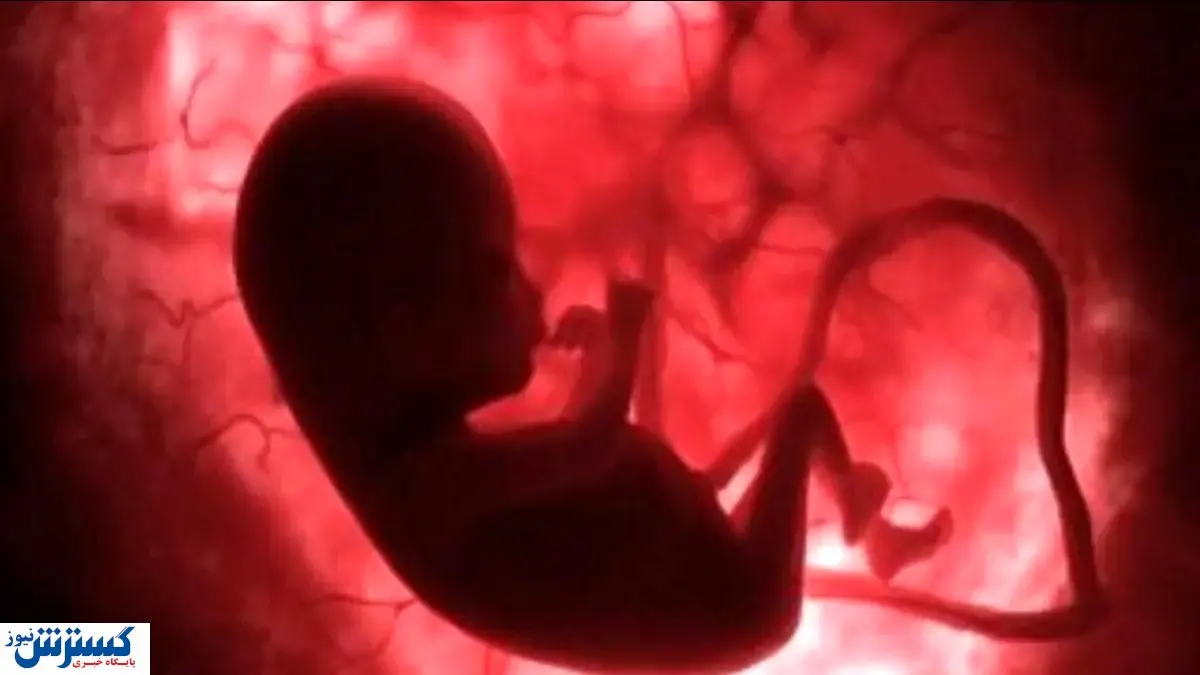 دولت شرایط سقط جنین قانونی را اعلام کرد | کدام روش بهتر است د؟