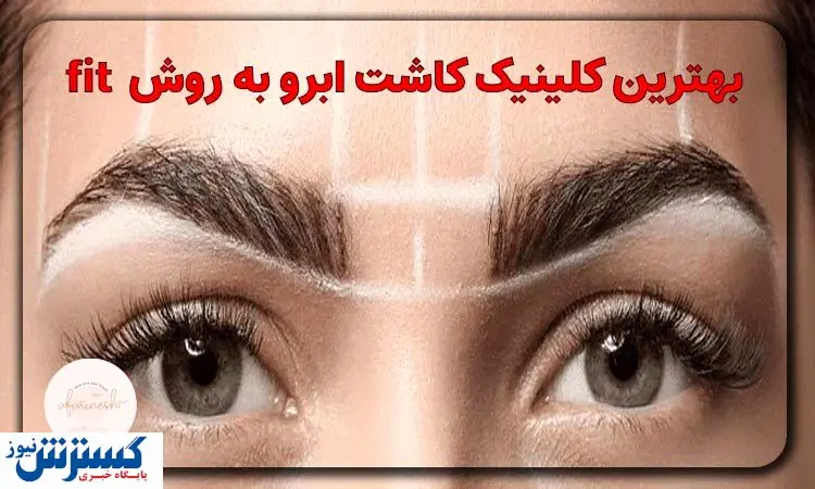 بهترین کلینیکهای کاشت ابرو به روش FIT در تهران
