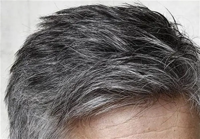 سفید شدن مو قبل ۴۰ سالگی علل جدی دارد