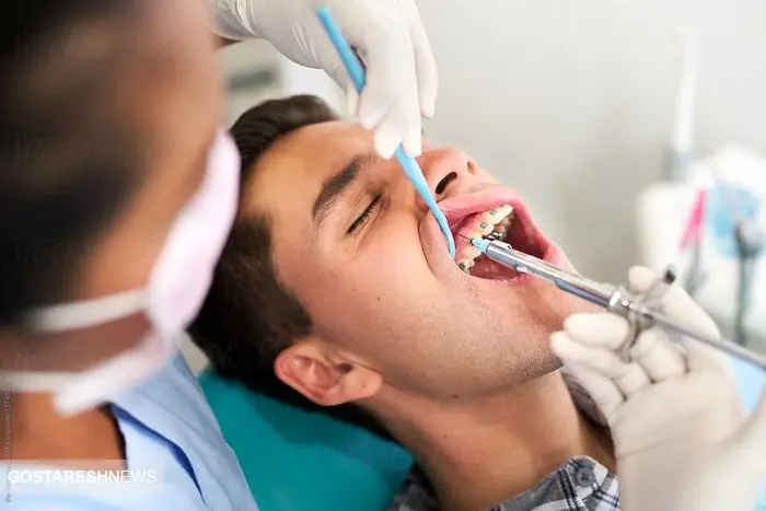 کشیدن دندان تنها چاره بیماران/درمان واجبی که بیمه حمایت نمیکند