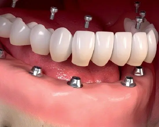 خدمات دندان پزشکی کلینیک دندان پزشکی دایادنت