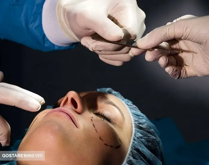 هزینه های جراحی زیبایی در کشورهای مختلف / درآمد وحشتناک پزشکان زیبایی