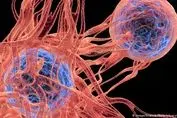 سرطانی که مردان دو برابر زنان به آن مبتلا می شوند