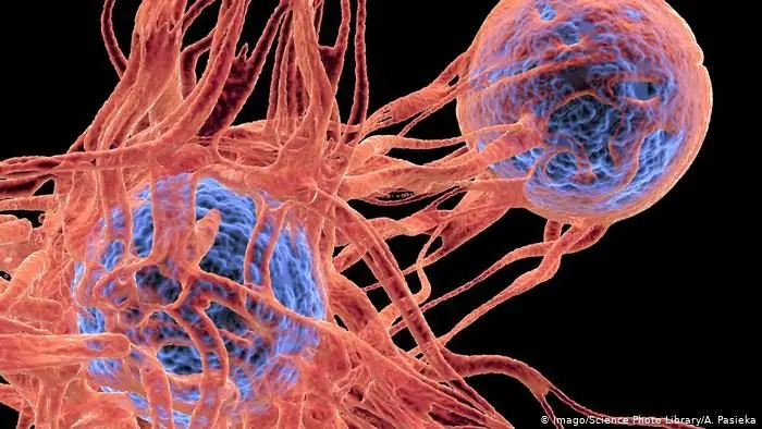 کشنده‌ترین سرطان‌ ها در زنان و مردان کدامند؟