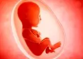 قرص های سقط جنین در دسترس تر  از استامینوفن است